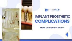 Implant prosthetics complications