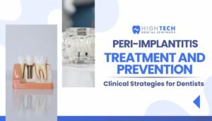 Peri-implantitis