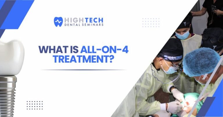 What Is All-on-4 Implant Treatment