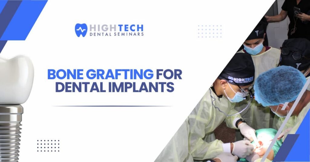 Bone Grafting for Dental Implants