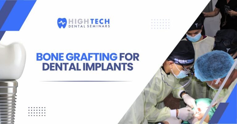 Bone Grafting for Dental Implants