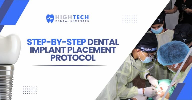 Step-by-Step Dental Implant Placement Protocol